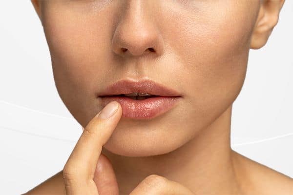 Lippenlifting Bullhorn Exzision