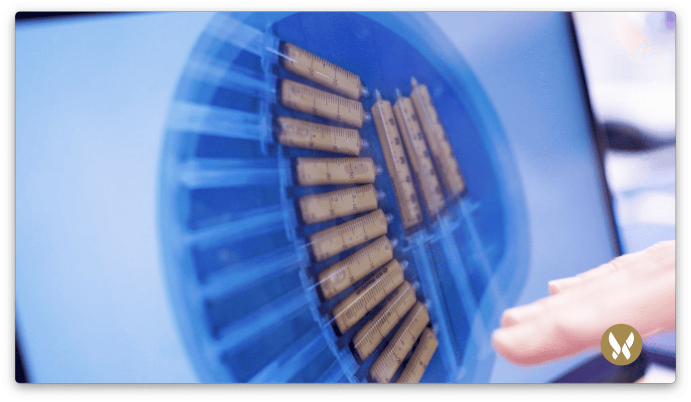 Spritzen mit autologem Fett