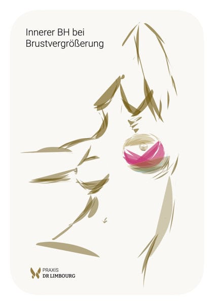 Brustvergrößerung innerer BH