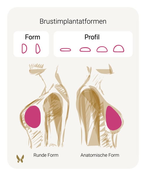 Implantatformen Dr. Limbourg